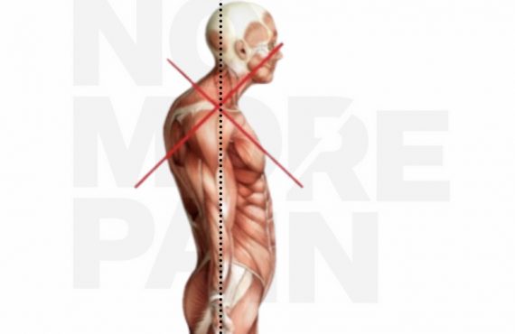 Poor posture